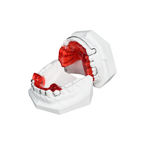 Plaque d'expansion orthodontique dentaire amovible en acrylique avec vis d'expansion - Product Image 2