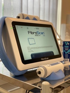 FibroScan 430 Mini+ Máquina Industrial y para Bricolaje OEM/ODM con 3 Años de Garantía - Product Image 1