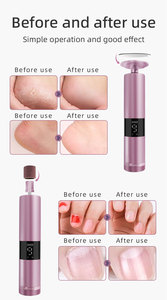 Lima eléctrica profesional para pies, removedor de callos y molinillo de piel muerta con almohadilla de papel de lija de repuesto, herramienta de pedicura - Product Image 2