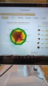 Analizador de Cuero Cabelludo con IA y Análisis Inteligente de la Piel, Compatible con UE/EE. UU., Uso Comercial, con WiFi - Product Image 5