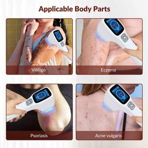 Dispositivo de Terapia de Luz Excimer de 308nm para el Tratamiento del Vitiligo, <span class=keywords><strong>Dermatitis</strong></span> Alérgica y Eczema Seco - Product Image 3