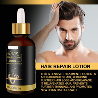 Minyak penumbuh rambut Losion Perbaikan sehat 30ml untuk pria wanita kebotakan kulit esensi rambut Sturgeon