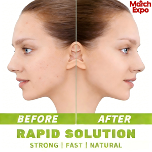 แคปซูลบำรุงผิวขาวส่วนตัว ผลิตภัณฑ์ดูแลสุขภาพ แคปซูลช่วยให้ผิวกระจ่างใส ลดเลือนริ้วรอยอย่างมีประสิทธิภาพ - Product Image 2