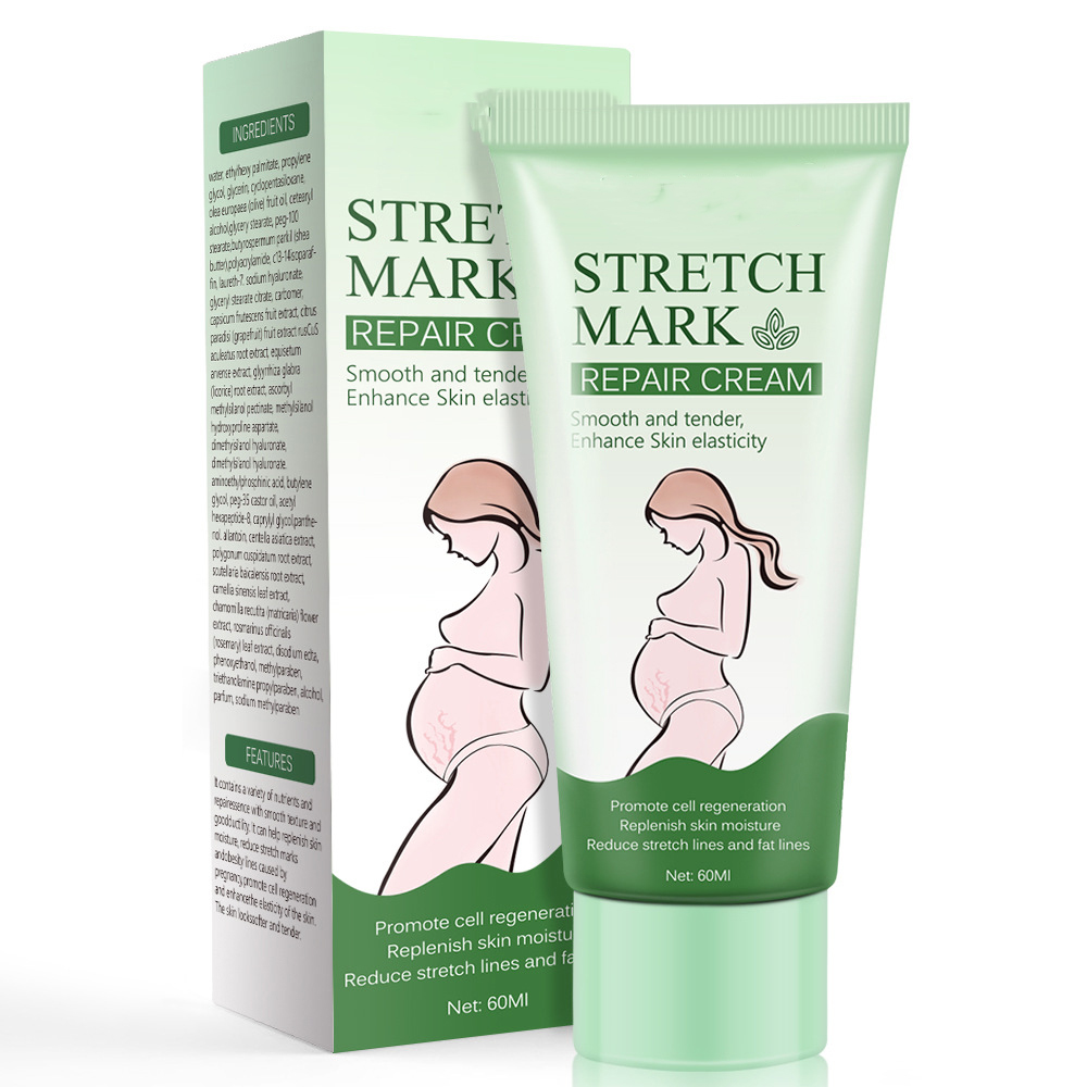 Postpartum stretch mark cream to relieve obesity lines, growth line repair cream to soften and enhance elasticity 60g