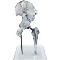 Modèle d'implant de hanche transparent KyrenMed, modèle de remplacement, mini taille, modèle d'affichage générique transparent