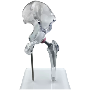 Kyrend पारदर्शी हिप संयुक्त इम्प्लांट मॉडल प्रतिस्थापन मॉडल मिनी आकार स्पष्ट जेनेरिक डिस्प्ले मॉडल - Product Image 1