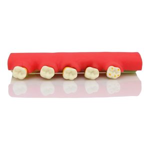 Modelo de Dientes Tipodonto para Demostración del Progreso de la Enfermedad Periodontal, Categoría Patología, para Enseñanza, Estudio y Demostración - Product Image 4