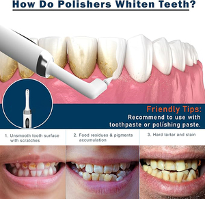 Vendita all'ingrosso di pulizia dentale ricaricabile 3 paste lucidanti 5 testine e ricarica USB Kit di sbiancamento dei denti per denti ogni giorno