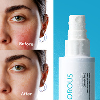 Nettoyant multi-usages pour les paupières de marque privée eczéma acné visage brouillard pour la peau vaporisateur d'acide hypochloreux