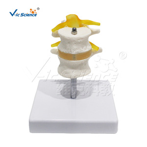 Modelo de vértebra humana de dos segmentos, material de PVC de alta precisión, estructura precisa, para demostración de patología en universidades - Product Image 1