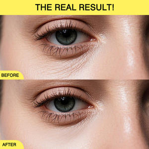 Crème pour <span class=keywords><strong>les</strong></span> <span class=keywords><strong>yeux</strong></span> multi-usages <span class=keywords><strong>Revive</strong></span> pour le visage et le cou avec du rétinol et des peptides - Product Image 4