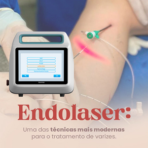 <span class=keywords><strong>Precio</strong></span> del <span class=keywords><strong>tratamiento</strong></span> EVLT/EVLA para venas varicosas endovenosas con ablación endovascular de 980 y 1470nm en Beijing Sunrise - Product Image 6