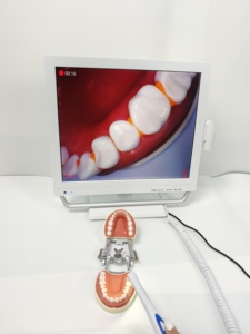 Équipement dentaire intelligent tout-en-un de haute qualité avec visualiseur <span class=keywords><strong>oral</strong></span> électrique, 2MP, mise au point 10-40mm, HDMI, application et support avec poignée - Product Image 2