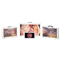Cámara de Endoscopia Médica Integrada Portátil de 24 Pulgadas Full HD 1080p para Veterinaria, Otorrinolaringología/Laparoscopia/Urología