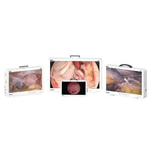 Kamera Endoskopi Medis Terintegrasi Portabel 24 Inci Full HD 1080p untuk Hewan THT/Laparoskopi/Urologi - Product Image 2