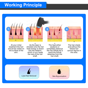Seaheart Portable 980Nm Diodo Láser Máquina de eliminación vascular Sangre roja Araña Vena Eliminación <span class=keywords><strong>Precio</strong></span> de fábrica para la venta - Product Image 5
