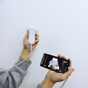 Konted MDRCE mesin <span class=keywords><strong>Doppler</strong></span> warna nirkabel, WIFI & USB pemeriksaan cembung 128 elemen 3.5Mhz Probe Ultrasound C10UR - Product Image 1
