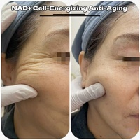 Poudre de NAD+ de qualité cosmétique avec peptides anti-âge, booster cutané NAD+, 100 mg, ampoules de poudre lyophilisée PDRN et peptides NAD+
