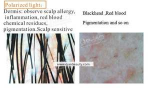 10 15 İnç Ekranlı 3D Akıllı Cilt Analiz Cihazı Profesyonel Güzellik Yüz Saç Tarayıcı Test Analiz Ekipmanı - Product Image 3