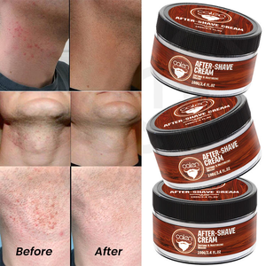 Crème après-<span class=keywords><strong>rasage</strong></span> pour hommes sous marque privée, réducteur de bosses de rasoir avec soin apaisant après-<span class=keywords><strong>rasage</strong></span> - Product Image 6