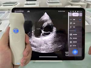 مسبار ملون لاسلكي محمول باليد ، مسبار جيب على شكل قلب صفيف مراحل لاسلكي - Product Image 3