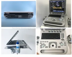 Instrument diagnostique d'ultrason de Doppler de couleur obstétrique de la machine 3D d'ultrason d'utilisation d'hôpital