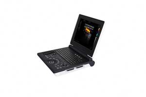 Chine Moins cher Portable 3D/4D Couleur Doppler Échographie Écho Machine, Diagnostic Système À Ultrasons pour Clinique MSLCU02 - Product Image 6