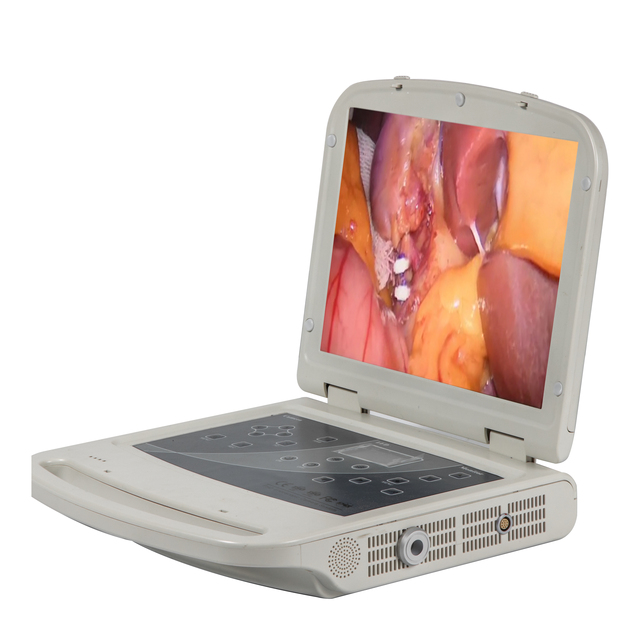 High Quality All in One Hysteroscopy Medical Endoscope Camera for Gynecology/Urology/ENT