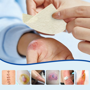 Pansement transfrontalier en alginate aux ions d'argent, stérilisation par irradiation, remplissage d'exsudat, pansement humide en gel pour plaies - Product Image 1