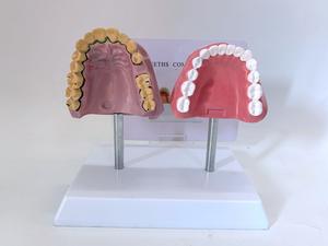 <span class=keywords><strong>Model</strong></span> pengajaran sains medis kedokteran gigi, sumber daya kesehatan manusia Oral dan merokok <span class=keywords><strong>Model</strong></span> Perbandingan mulut - Product Image 2