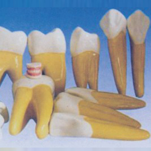 Modèle dentaire médical ADA pour adulte Sylloge (32 dents) – Modèle d'amplification dentaire (15 fois l'agrandissement) pour l'enseignement et l'apprentissage de l'anatomie Shanghai - Product Image 6