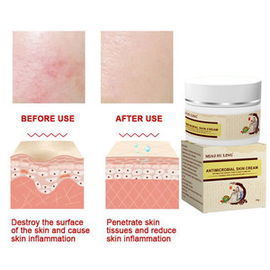 Krim kaya kelembaban Oem, dengan salep eksim Herbal tekstur kulit untuk menenangkan Itchiness dan meningkatkan - Product Image 4