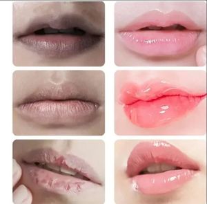 Bálsamo Labial de Frutas en Oferta, Reduce las Arrugas, Hidrata, Blanquea y Rejuvenece, Venta al por Mayor de Fábrica - Product Image 2