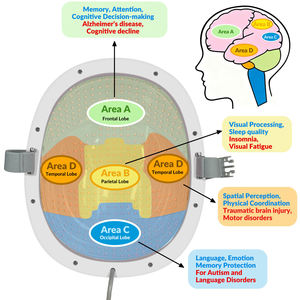 Casco de Fotobiomodulación por Infrarrojo Cercano de 810nm, Equipo de Fototerapia No Invasiva para el Cuidado Cerebral, Demencia, Alzheimer, <span class=keywords><strong>Parkinson</strong></span>, Accidente Cerebrovascular - Product Image 5