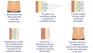 Appareil d'analyse cutanée <span class=keywords><strong>C8</strong></span> Cryoskin, homologué CE, facile à utiliser, pour le remodelage corporel et l'amincissement, destiné aux cliniques de beauté et spas. - Product Image 6