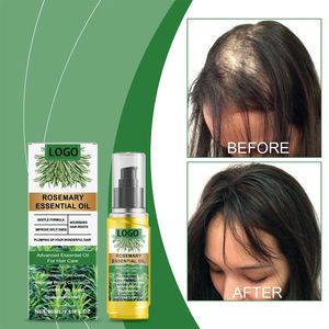 Olio essenziale di rosmarino rafforzamento della crescita dei capelli radici nutrienti per la cura dei capelli olio essenziale - Product Image 3