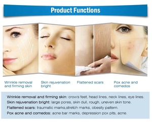 Appareils de <span class=keywords><strong>radiofréquence</strong></span> pour traitements esthétiques, <span class=keywords><strong>micro</strong></span>-aiguilletage avec <span class=keywords><strong>radiofréquence</strong></span> <span class=keywords><strong>fractionnée</strong></span>, dispositif de lifting du visage par <span class=keywords><strong>micro</strong></span>-aiguilletage RF - Product Image 3