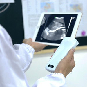 Apparecchiature diagnostiche a ultrasuoni a trasduttore convesso con impugnatura Wifi 128e di piccole dimensioni Konted MDR - Product Image 2
