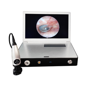 Cámara endoscópica de Urología eléctrica FHD con pantalla <span class=keywords><strong>integrada</strong></span> y almacenamiento de vídeo para uso en cirugía hospitalaria - Product Image 3