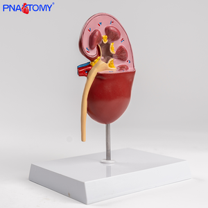 Modello Anatomico di Reni Normali e Malati a Grandezza Naturale, Strumento Didattico per il Sistema Urinario, Attrezzatura Educativa, Regalo Medico - Product Image 4