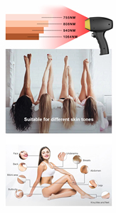 Máquina de Depilación Láser de Diodo 808nm de 1000W con Sistema de Enfriamiento por Agua, Depiladora Permanente para Salón de Belleza y Spa, Suministro de Fábrica - Product Image 4