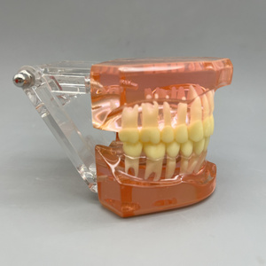 ฟันเรซินรูปแบบเปรียบเทียบทางทันตกรรมสำหรับการสื่อสารและการสาธิตผู้ป่วยในคลินิก - Product Image 5