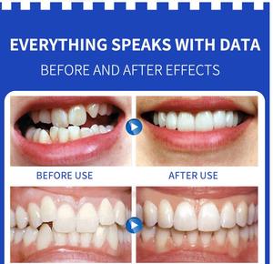 Dropshipping 3 Stadia Fysieke Volwassen Tand Correctie Therapie Uitlijning Retainer Orthodontische Tanden Trainer - Product Image 4