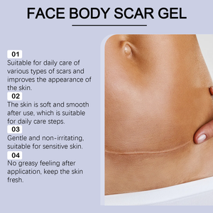 Crème naturelle pour le soulagement des cicatrices corporelles 28g Douce Non irritante Pour une utilisation quotidienne - Product Image 5