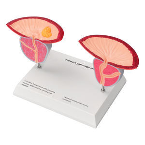 Modelo Anatómico Patológico de Próstata Humana para Enseñanza y Formación Médica, Material de PVC, Modelo Anatómico para Educación Científica - Product Image 4