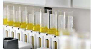 Analyseur de sédiments d'<span class=keywords><strong>urine</strong></span> entièrement automatisé/analyseur d'<span class=keywords><strong>urine</strong></span> 120 T/H Machine d'analyse d'<span class=keywords><strong>urine</strong></span> - Product Image 5