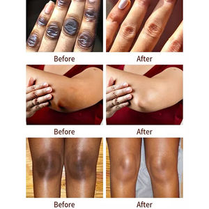 كريم ولوشن متطور لتفتيح وترطيب البشرة بتصنيع المعدات الأصلية للوجه والجسم ومنطقة البكيني وداخل الفخذين ومصحح للبقع الداكنة والتصبغات - Product Image 5