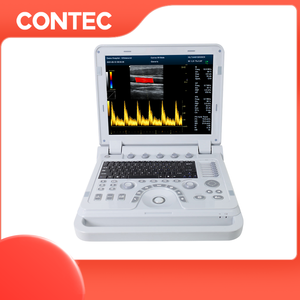 Contacec 1700A Ultrasound vaskuler monokuler sonografi profesional 1700A - Product Image 3