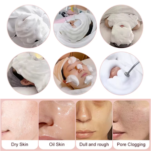 Zs Spa ma thuật oxy Máy bong bóng toàn bộ cơ thể sâu làm sạch dịu dàng Trắng ve loại bỏ da trẻ hóa da quản lý thiết bị - Product Image 6