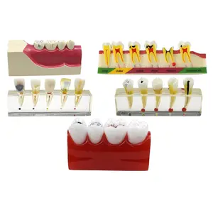 Modèle de dents dentaires à prix d'usine modèle d'implant dentaire pour les ressources d'enseignement